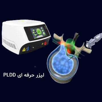 لیزر حرفه ای درمان دیسک کمر - PLDD