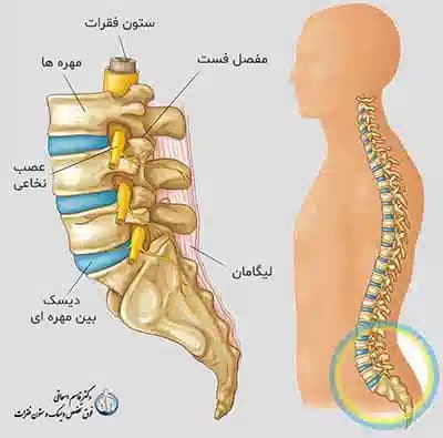 دیسک کمر  چیست؟ تشخیص و علائم و درمان دیسک کمر