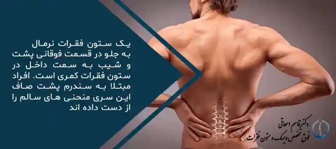 گودی کمر چیست؟
