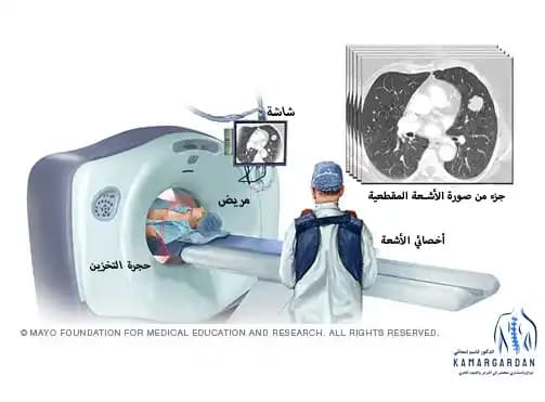 التصوير المقطعي بالكمبيوتر (CT SCAN)
