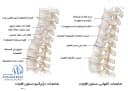 أنواع مرض القرص القطني