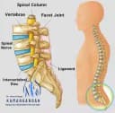 Lumbar disc herniation or lumbar disc disease