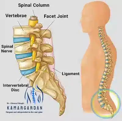 Lumbar disc herniation or lumbar disc disease