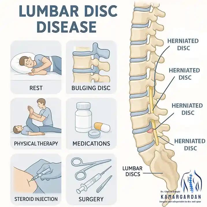 Treatment of Lumbar Disc Disease