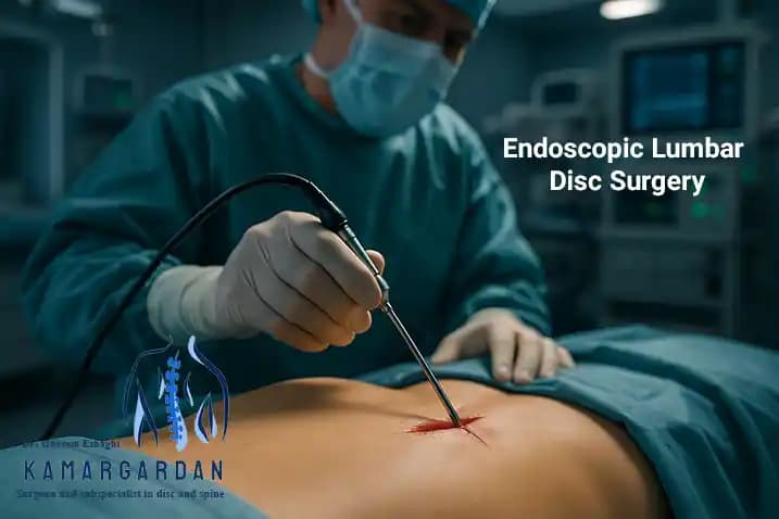 Endoscopic Lumbar Disc Surgery