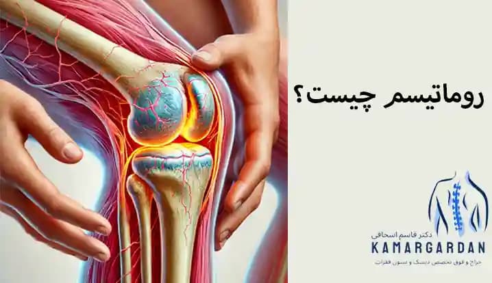 روماتیسم چیست؟ روماتیسم چیست؟