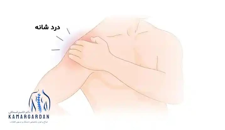 درد شانه و مشکلات شایع شانه درد شانه و مشکلات شایع شانه