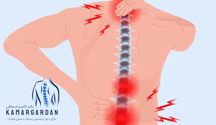 علائم دیسک کمر خطرناک علائم دیسک کمر خطرناک