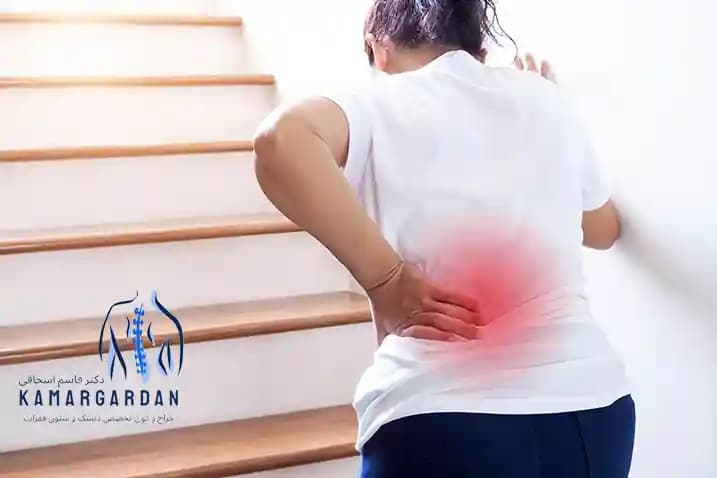 علت درد پایین کمر در زنان علت درد پایین کمر در زنان