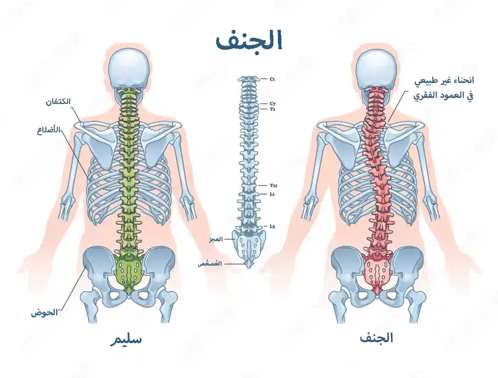 تمارين الجنف تمارين الجنف