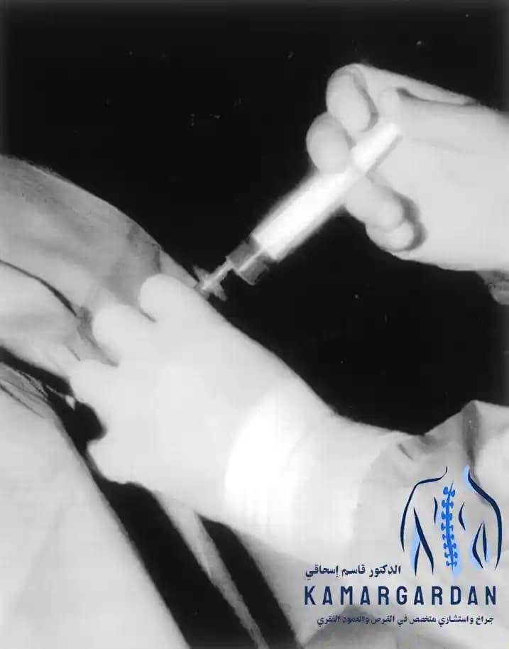 العلاج الجراحي البسيط لتمزق القرص القطني بالأوزون العلاج الجراحي البسيط لتمزق القرص القطني بالأوزون