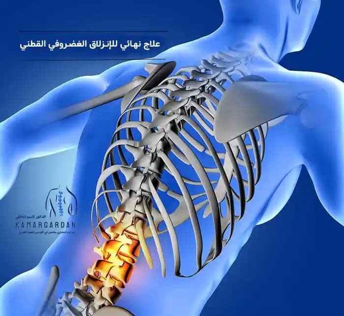 هل يوجد علاج نهائي للإنزلاق الغضروفي القطني؟ هل يوجد علاج نهائي للإنزلاق الغضروفي القطني؟