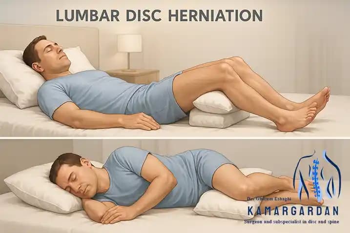 How to Rest for Treating a Lumbar Disc Herniation How to Rest for Treating a Lumbar Disc Herniation